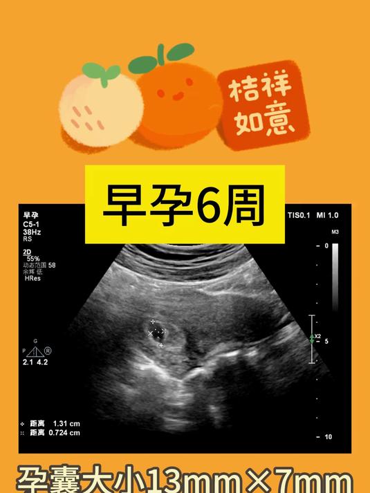 怀孕6周，重点需要关注孕囊胎心胎芽指标，hcg孕酮