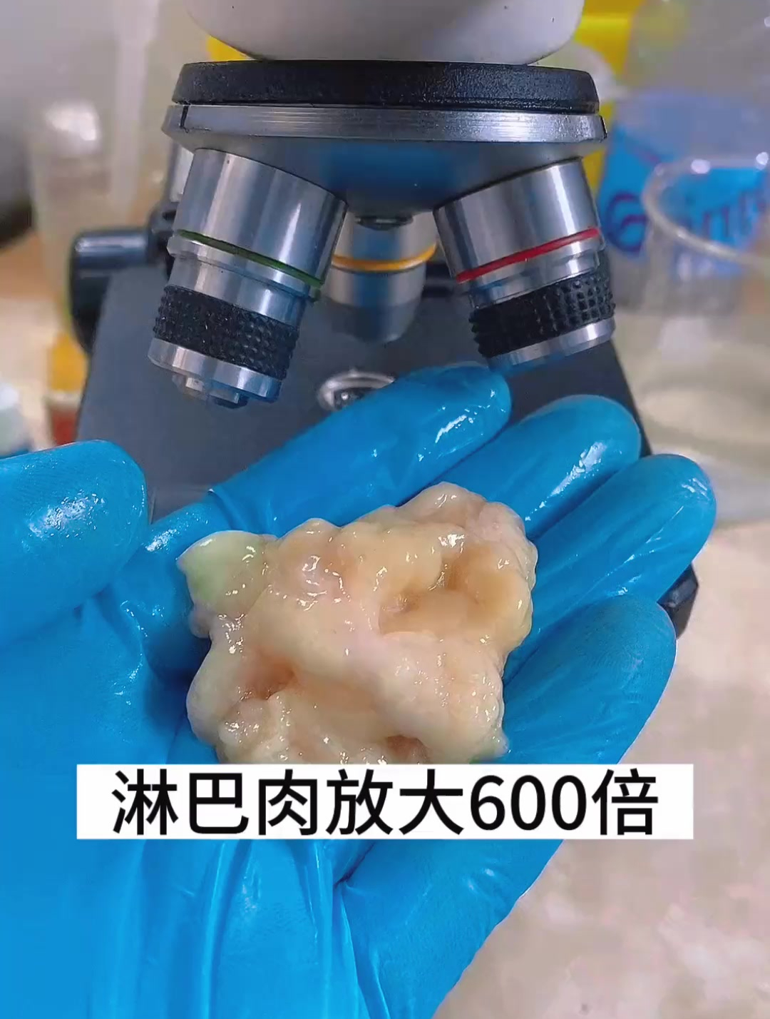淋巴肉放大600倍,少吃肥肉尽量避免