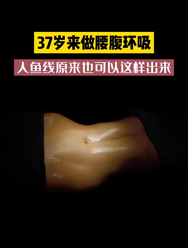 37岁求美者来长沙做腰腹吸脂,原来人鱼线是这样出来的