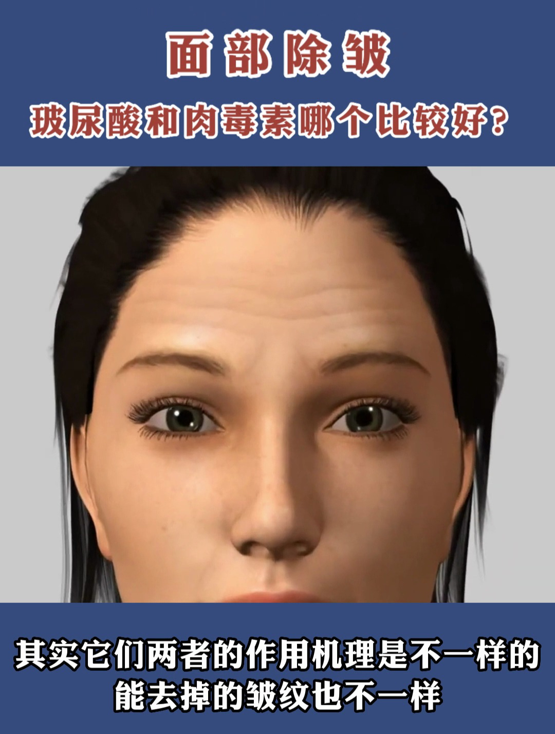 面部除皱,玻尿酸和肉毒素该选哪一个?