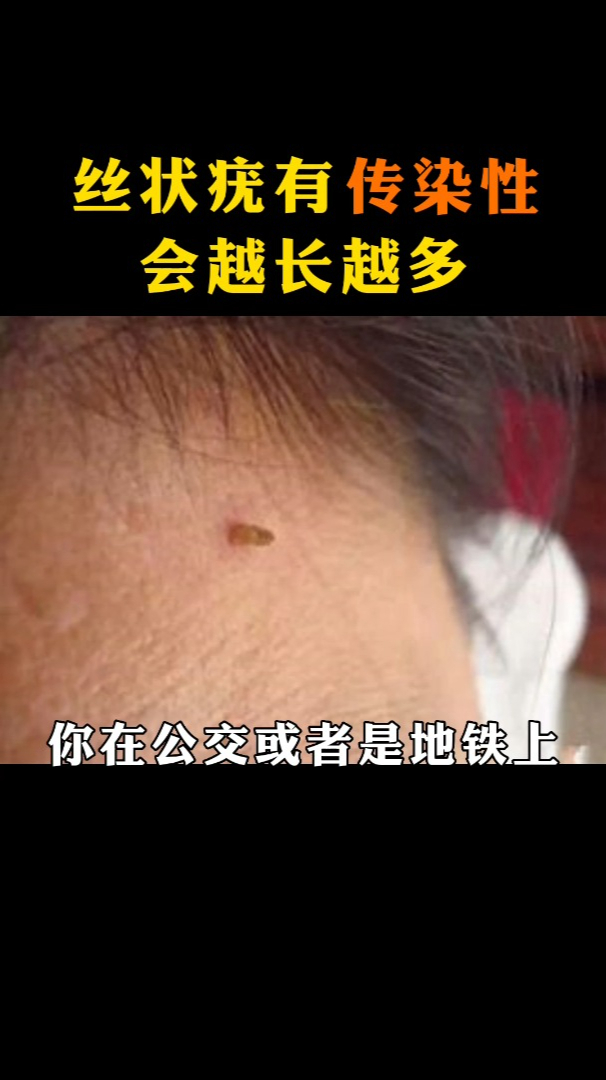 脖子上的小肉丁,千万别揪,可能会传染