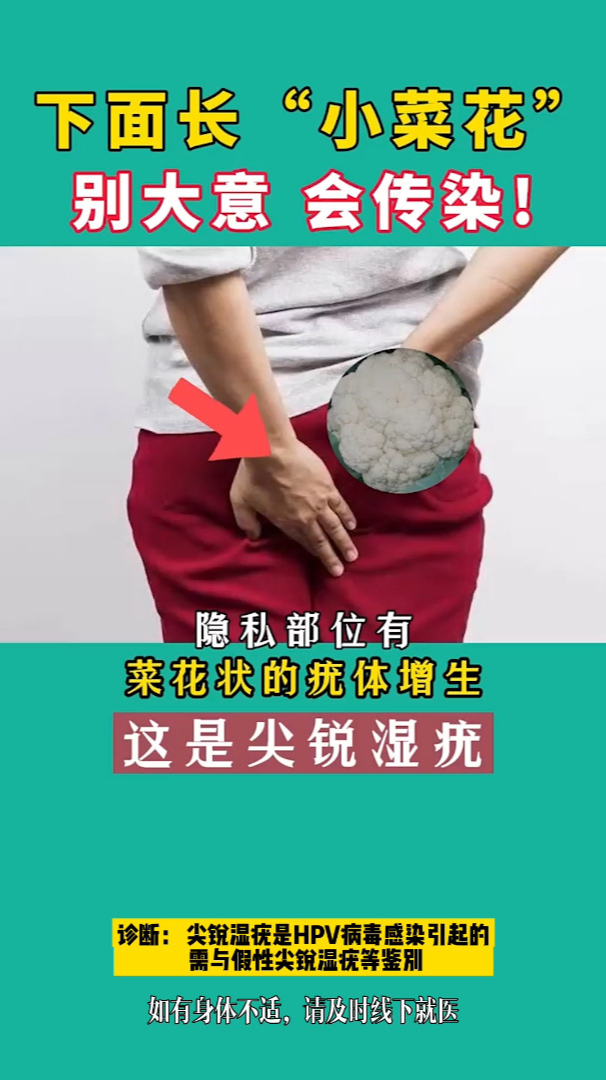 私处长了小菜花,别不在意,可能是这种X病