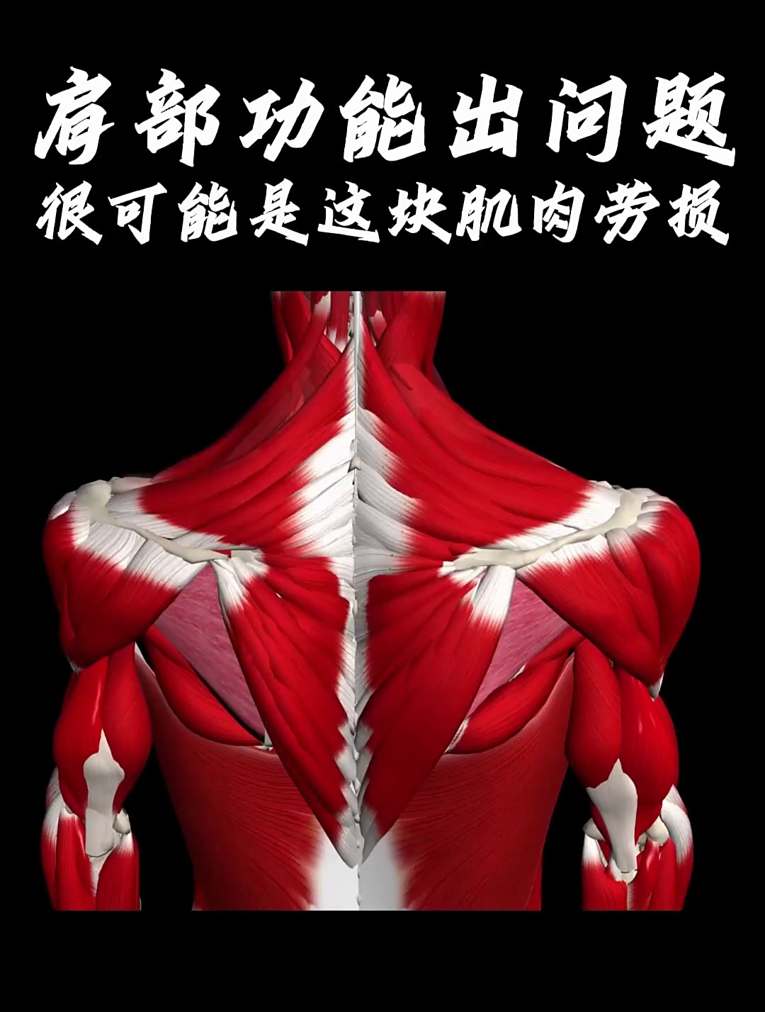 肩部最容易出问题的一块肌肉