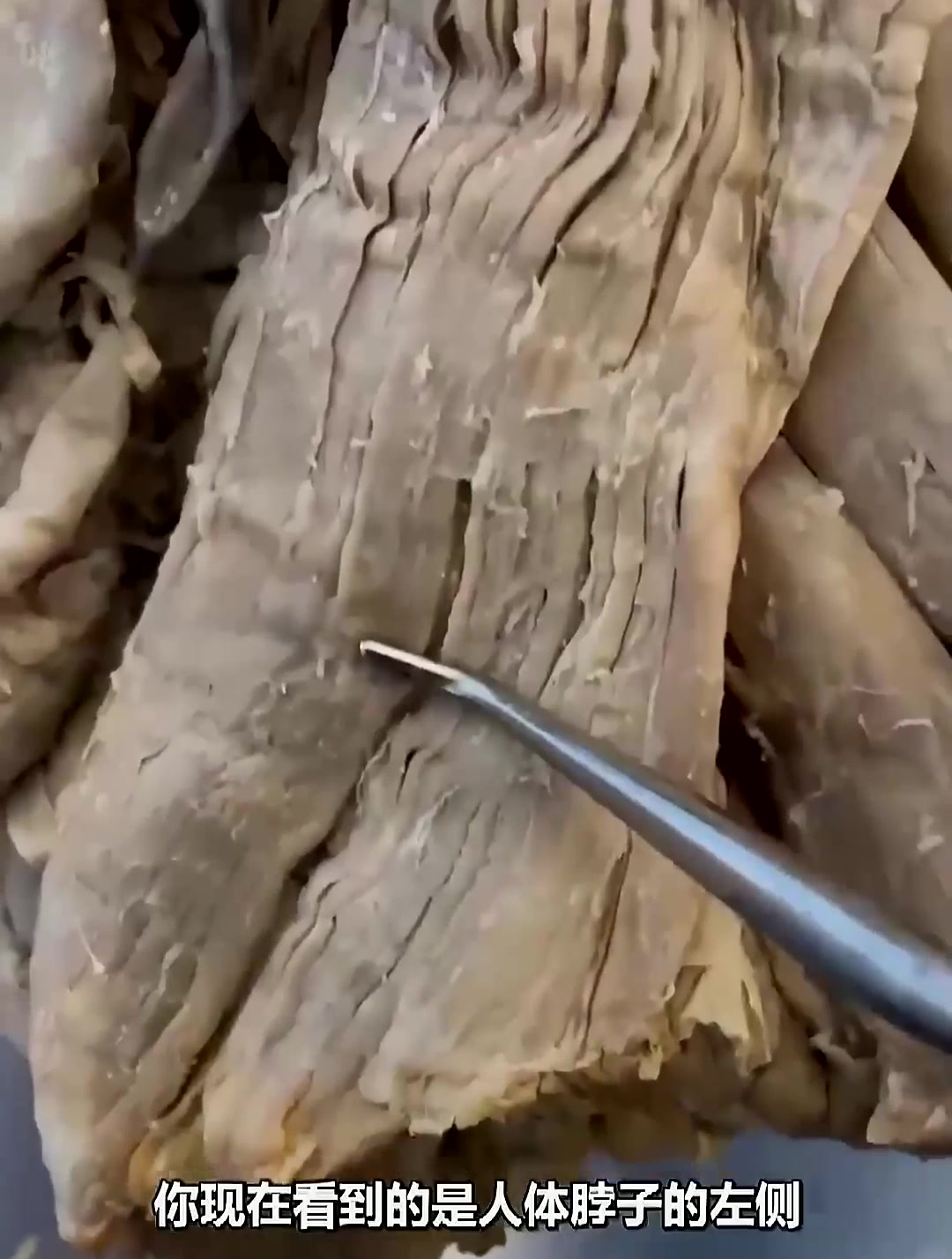 脖子的肌肉收缩的作用