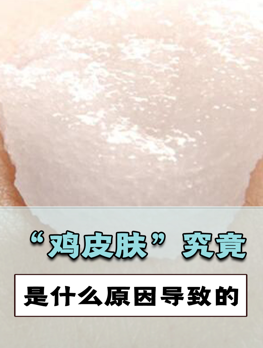 “鸡皮肤”到底是怎么产生的?该怎么改善?