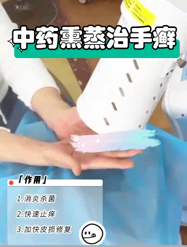 上海江城-中药熏蒸治疗手癣