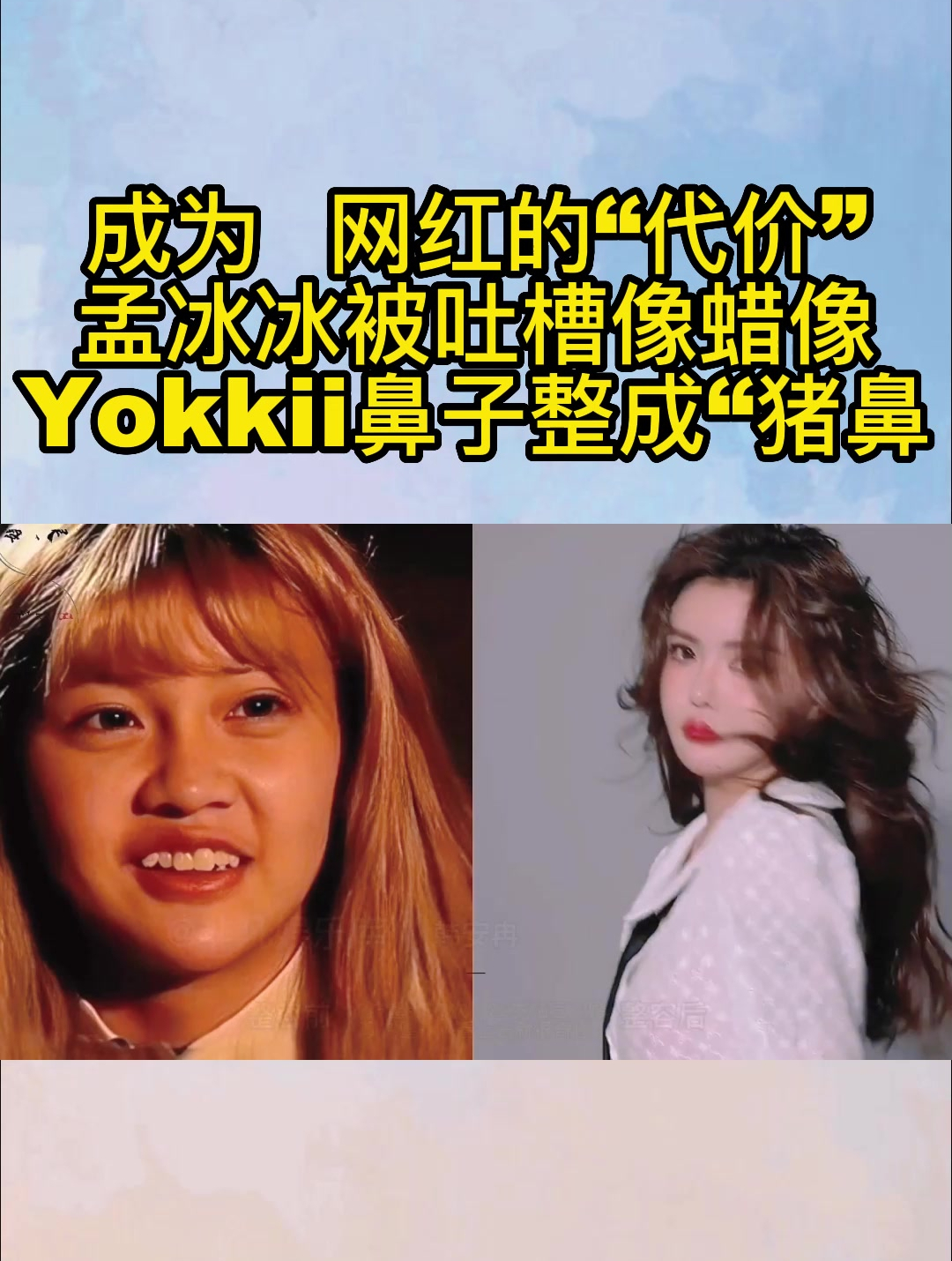 成为网红的“代价“,孟冰冰被吐槽像蜡像,Yokkii鼻子整成“猪鼻