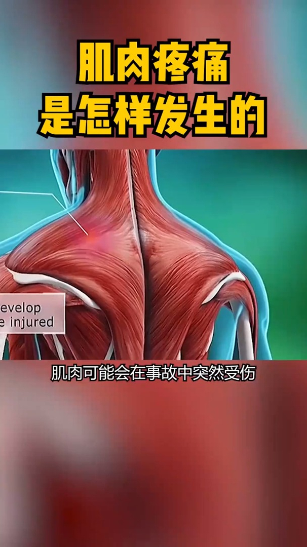 生物老师不会讲的,肌肉为何会酸痛,微观世界涨知识!
