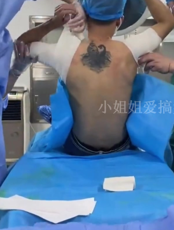 女友为了表示爱意,给男友舔腋窝吸草莓,男友患上狐臭来手术