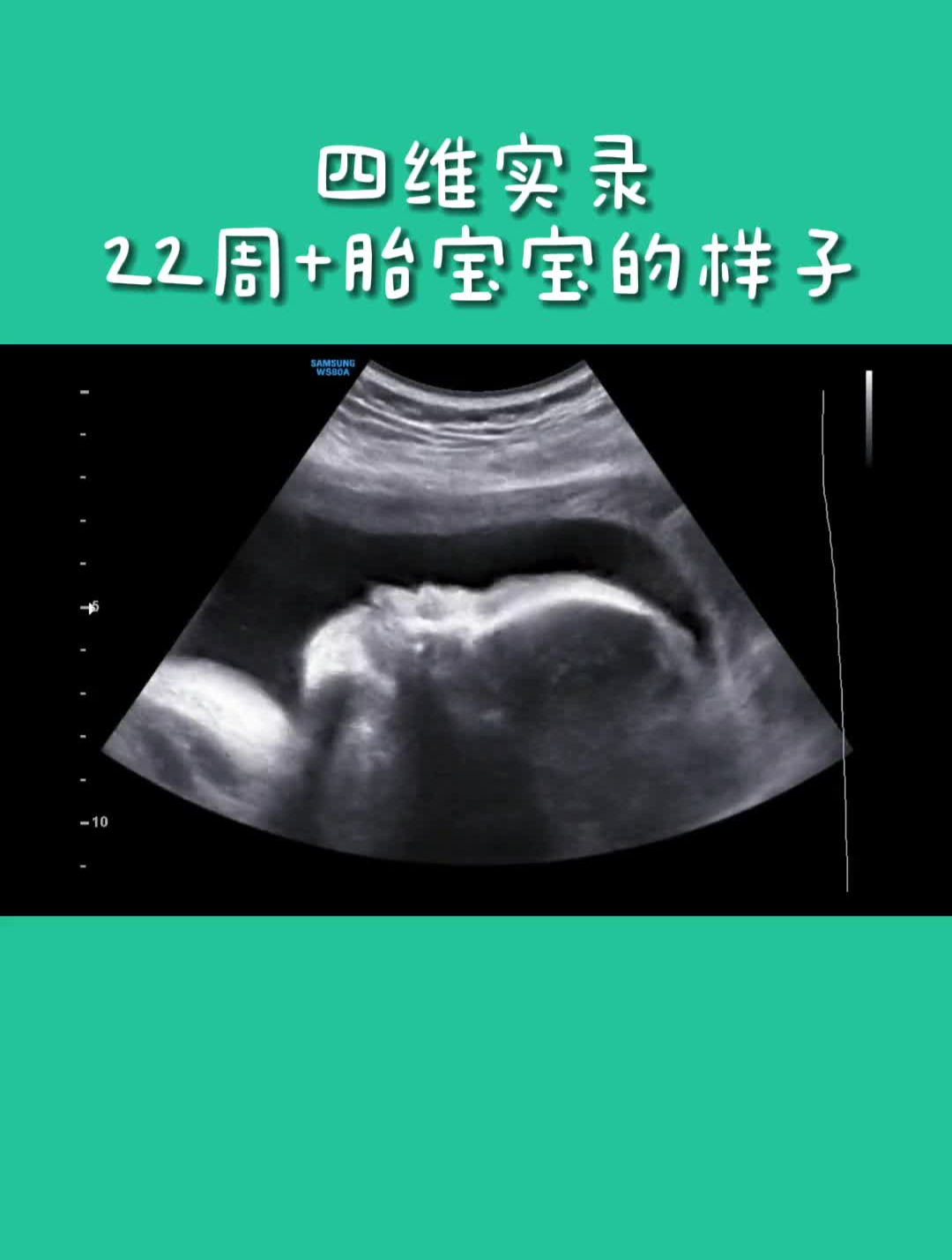 四维实录22周+胎宝宝在妈妈肚子里的样子!孕期孕妈