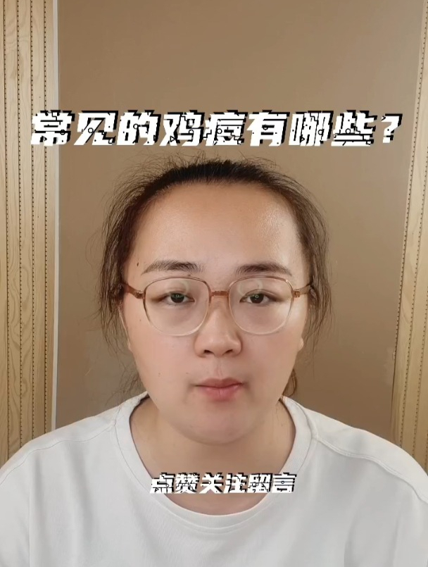 常见的鸡痘有哪些?