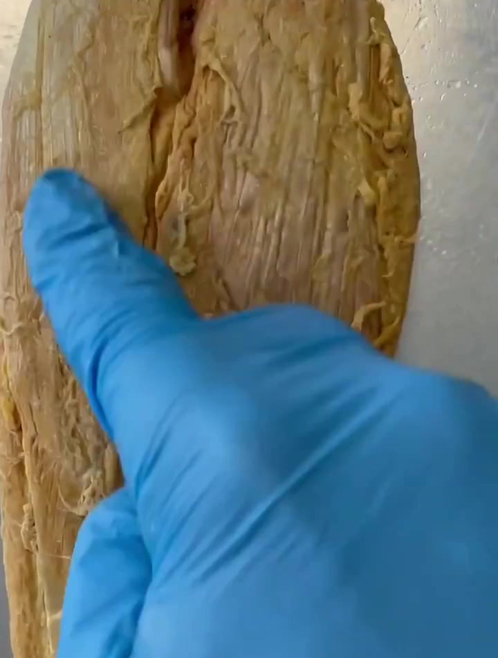 这是小腿的一块肌肉