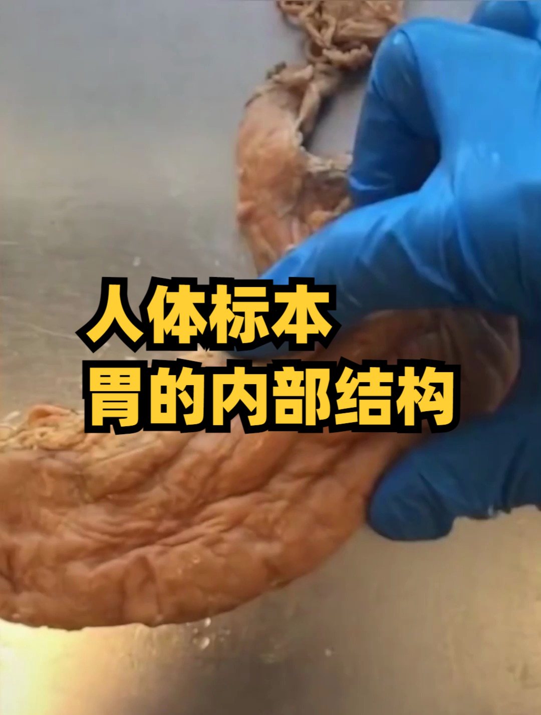 人体标本,胃的内部结构