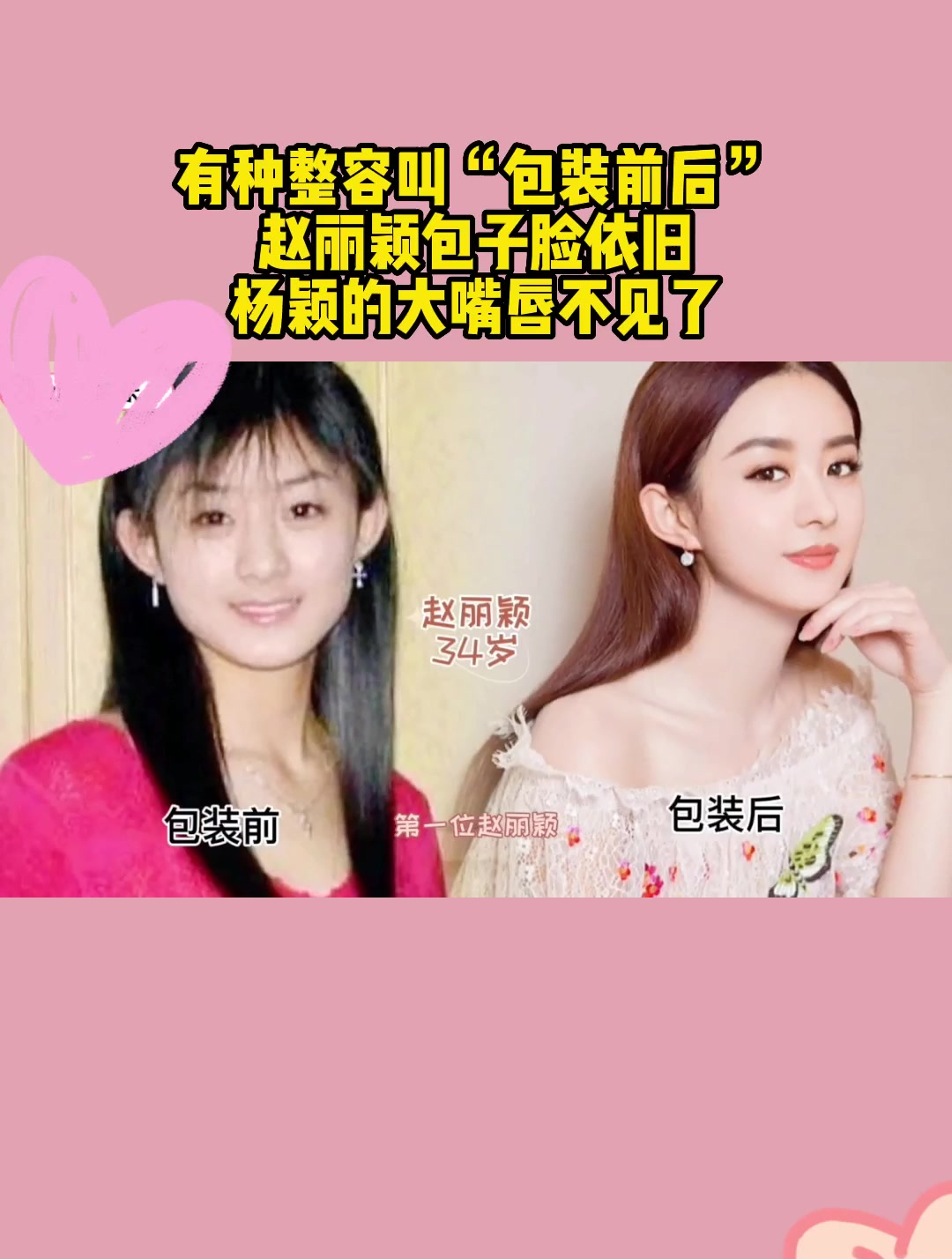 有种整容叫“包装前后”,赵丽颖包子脸依旧,杨颖的大嘴唇不见了