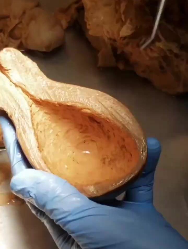 子宫的结构科普!