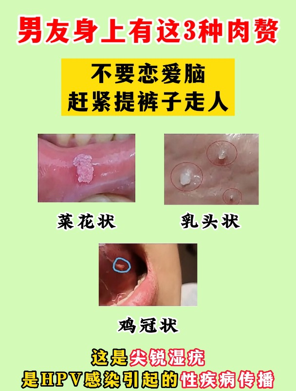 男友身上有这3种肉赘,不要恋爱脑赶紧提裤子走人!