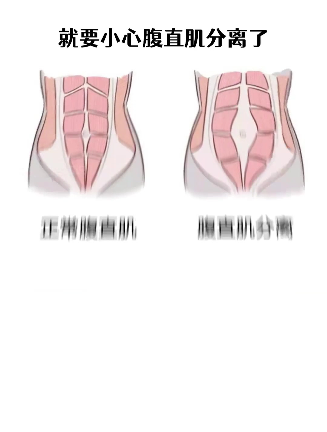 下腹突出,肚子分层,抓紧练习“萨尔曼进阶动作”