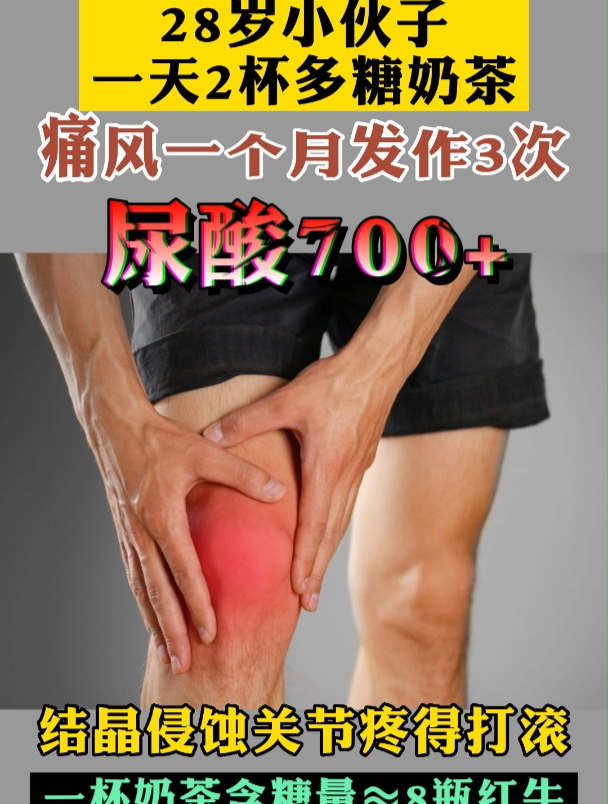 奶茶含糖量太高,高尿酸患者尽量少喝!