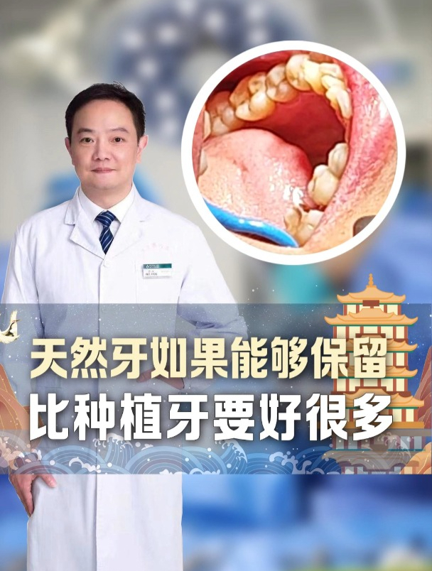 天然牙比种植牙好