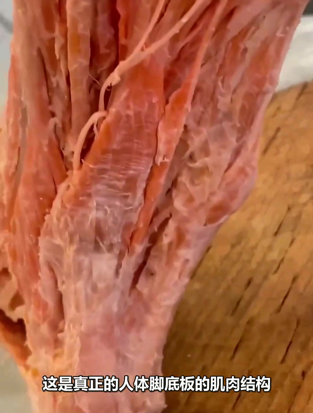 这是人体脚底板的肌肉标本