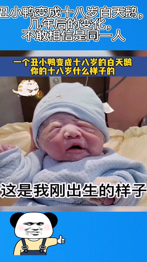一个丑小鸭变成十八岁白天鹅,几年的变化,不敢相信是同一人