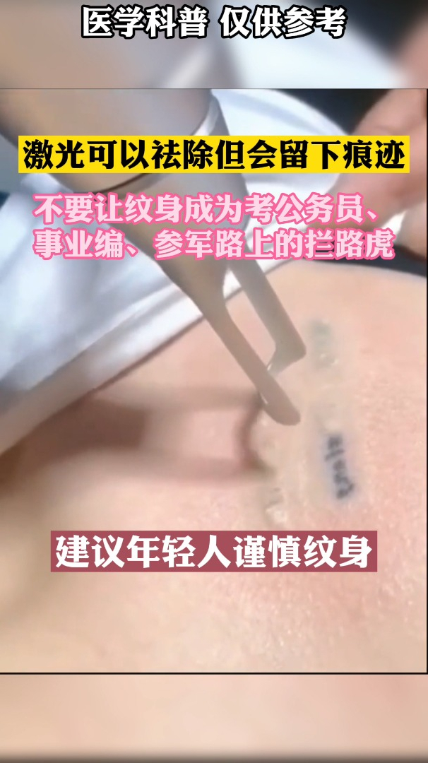 纹身虽好看,但是去除会留痕迹,年轻人不要一时冲动