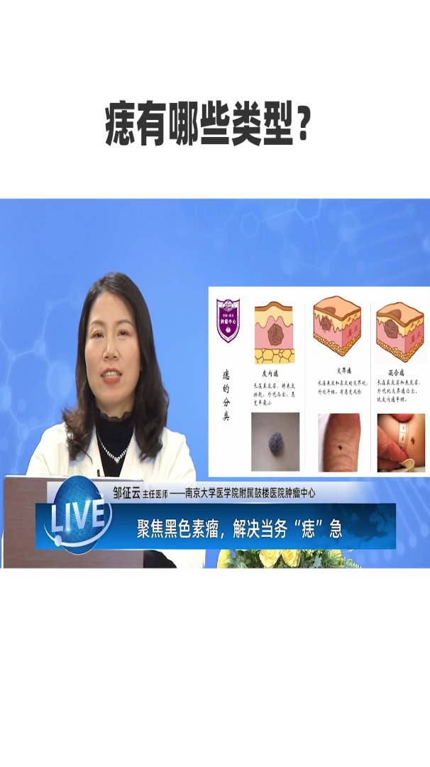 痣有哪些类型呢?
