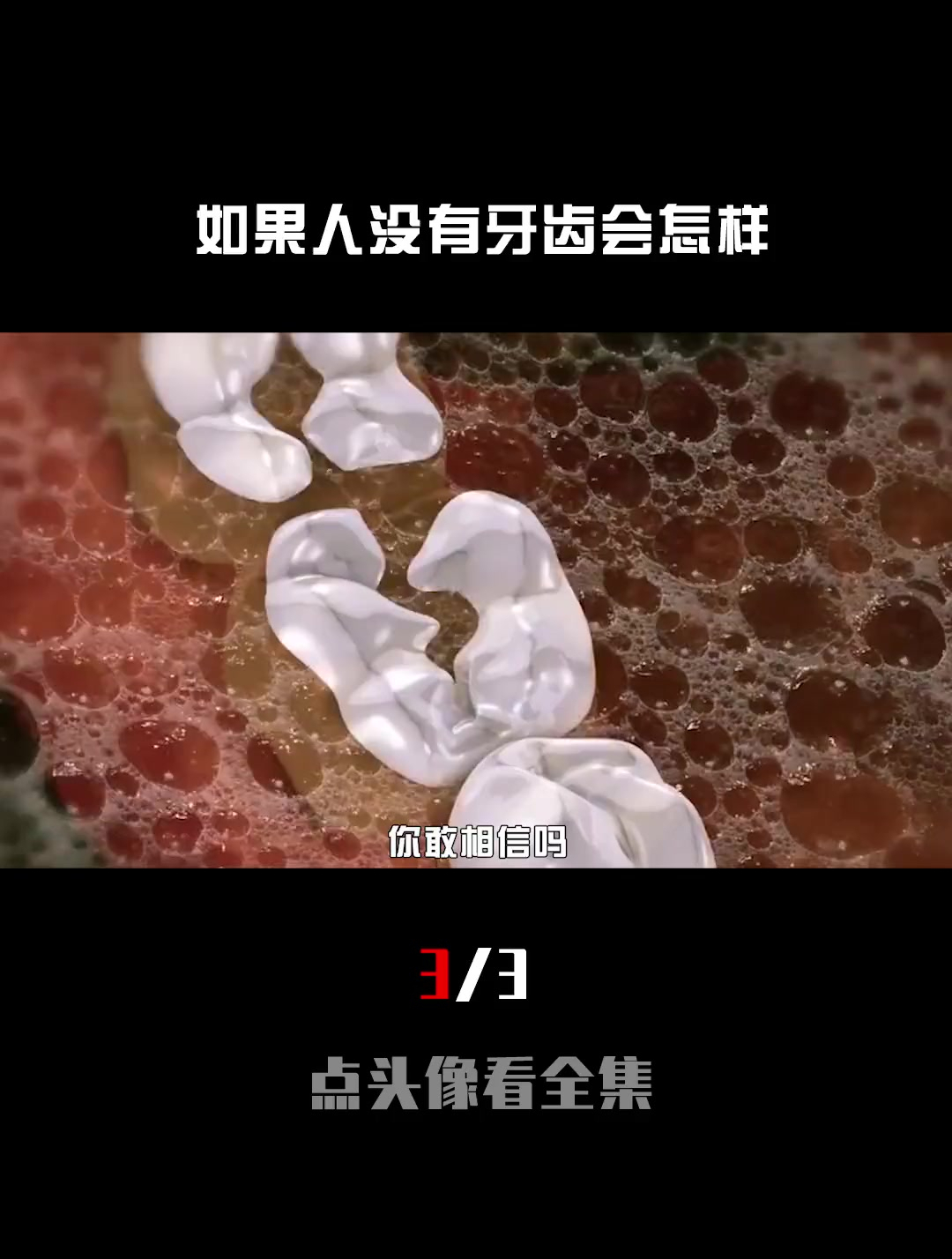 如果人突然失去所有牙齿,生活会发生什么?结果不简单(3_3)