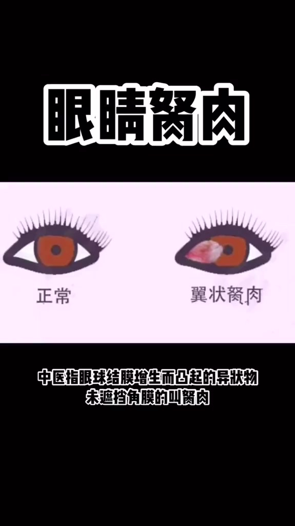 你知道眼睛里的“鱼肉”吗?