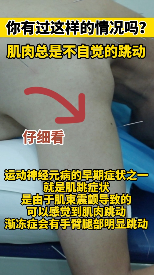 身上肌肉“跳动”别大意,别再误以为是抽筋了,或是肌萎缩的前兆