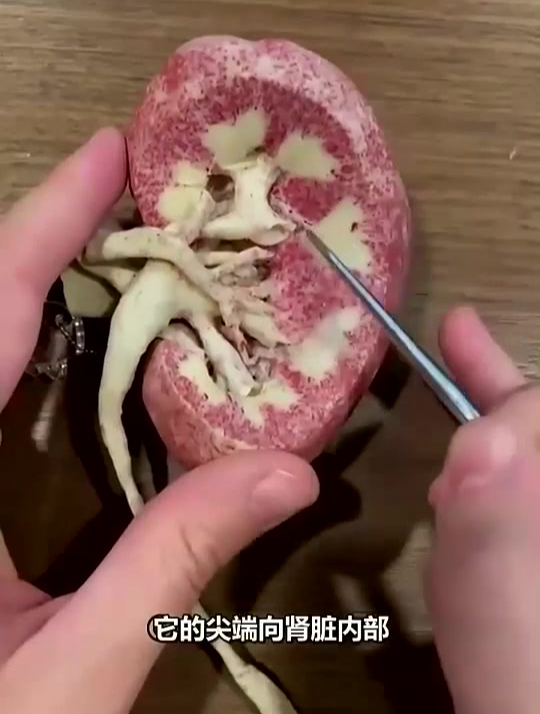 清晰的肾脏剖面功能讲解