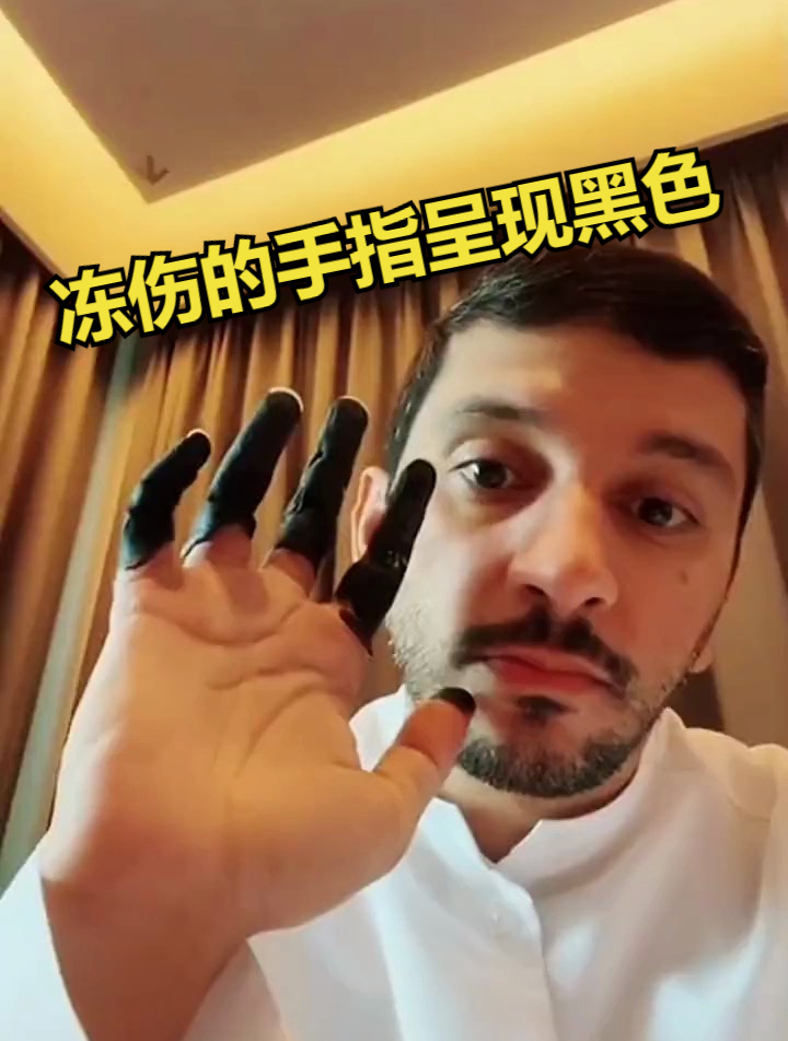 原来冻伤的手指竟然会呈现黑色