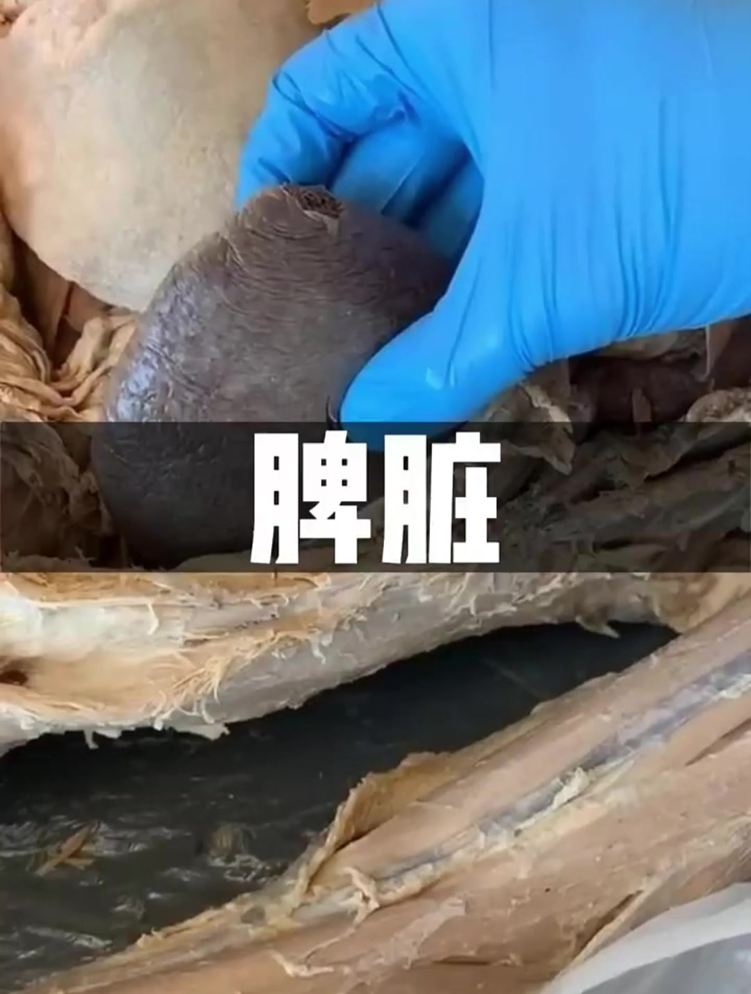这是人体的脾脏标本