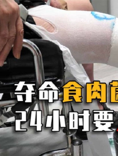 “吃人”的食肉菌到底多恐怖?最快24小时要人命看完直冒冷汗!1