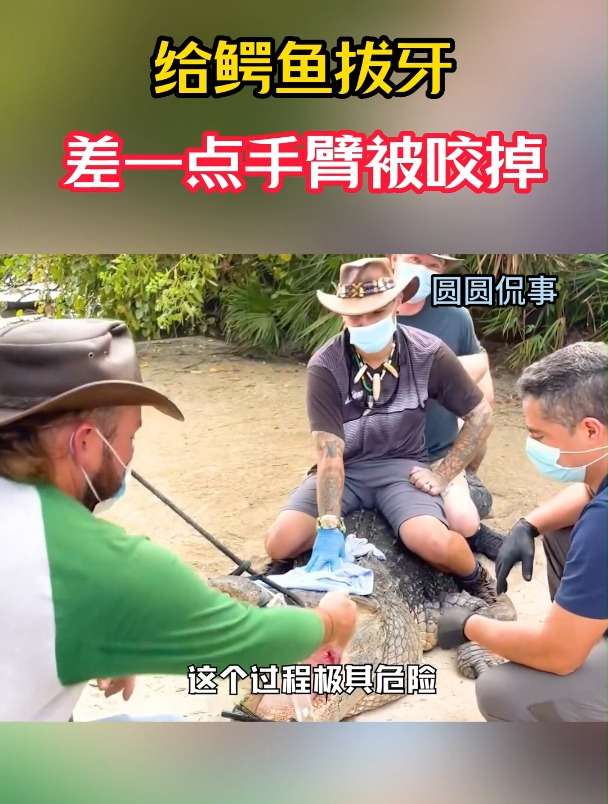 给鳄鱼拔牙,差一点手臂被咬掉