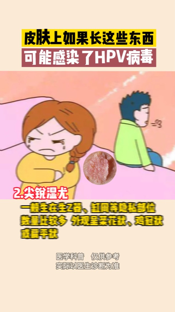 皮肤上如果长这些东西,可能是HPV感染