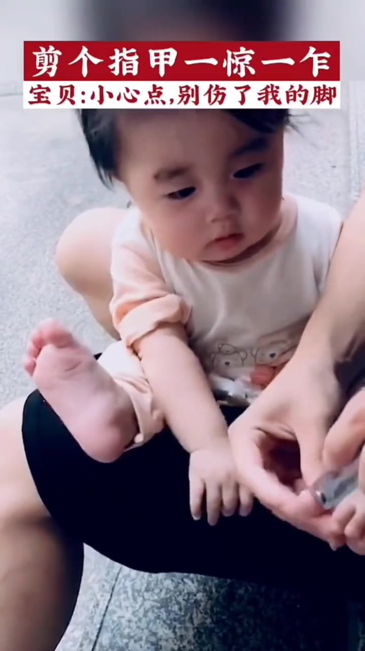 指甲很厚很硬,经常长肉里的,一定要入手这个鹰嘴指甲钳