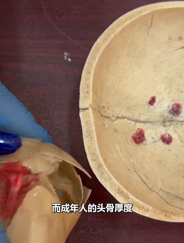 人体结构:婴幼儿头骨