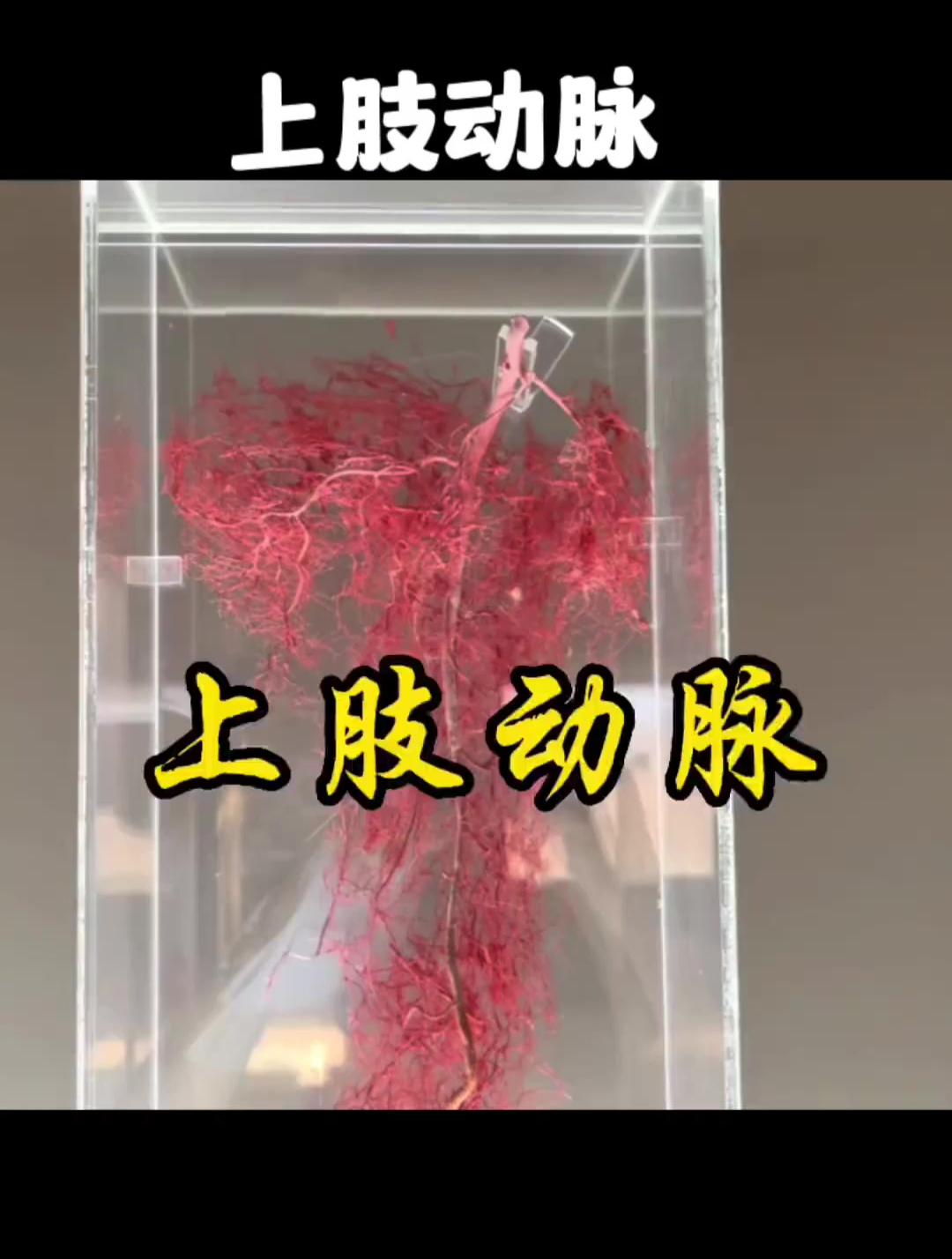 上肢动脉血管分布