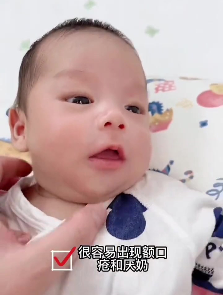 宝宝如何清洁口腔,预防厌奶期和鹅口疮?