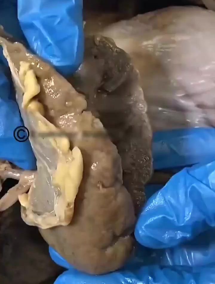 这是我们人体肾脏的内部结构