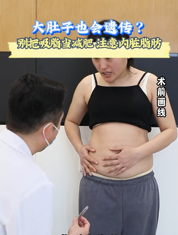 大肚子也会遗传?