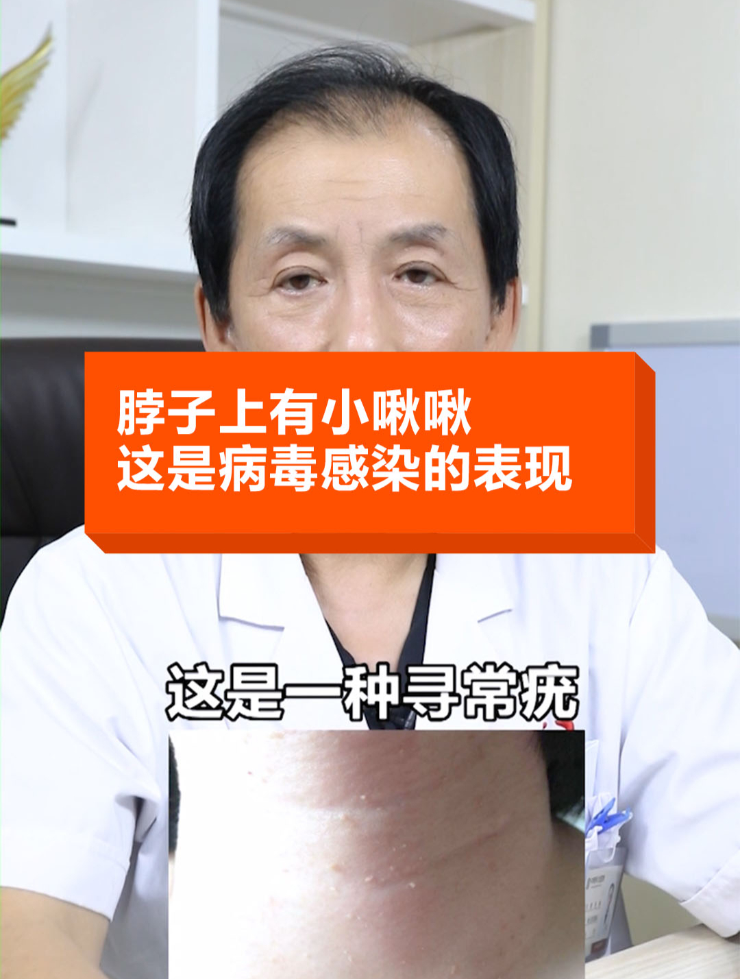 脖子上有小秋秋,这是病毒感染的表现