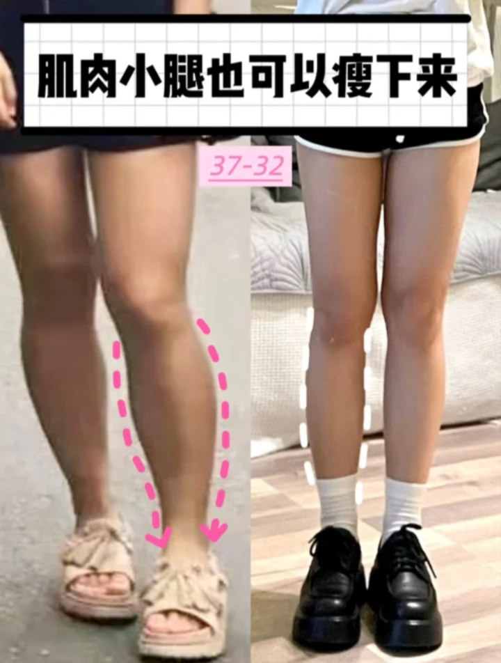 超全的肌肉小腿攻略!我已经了5cm!
