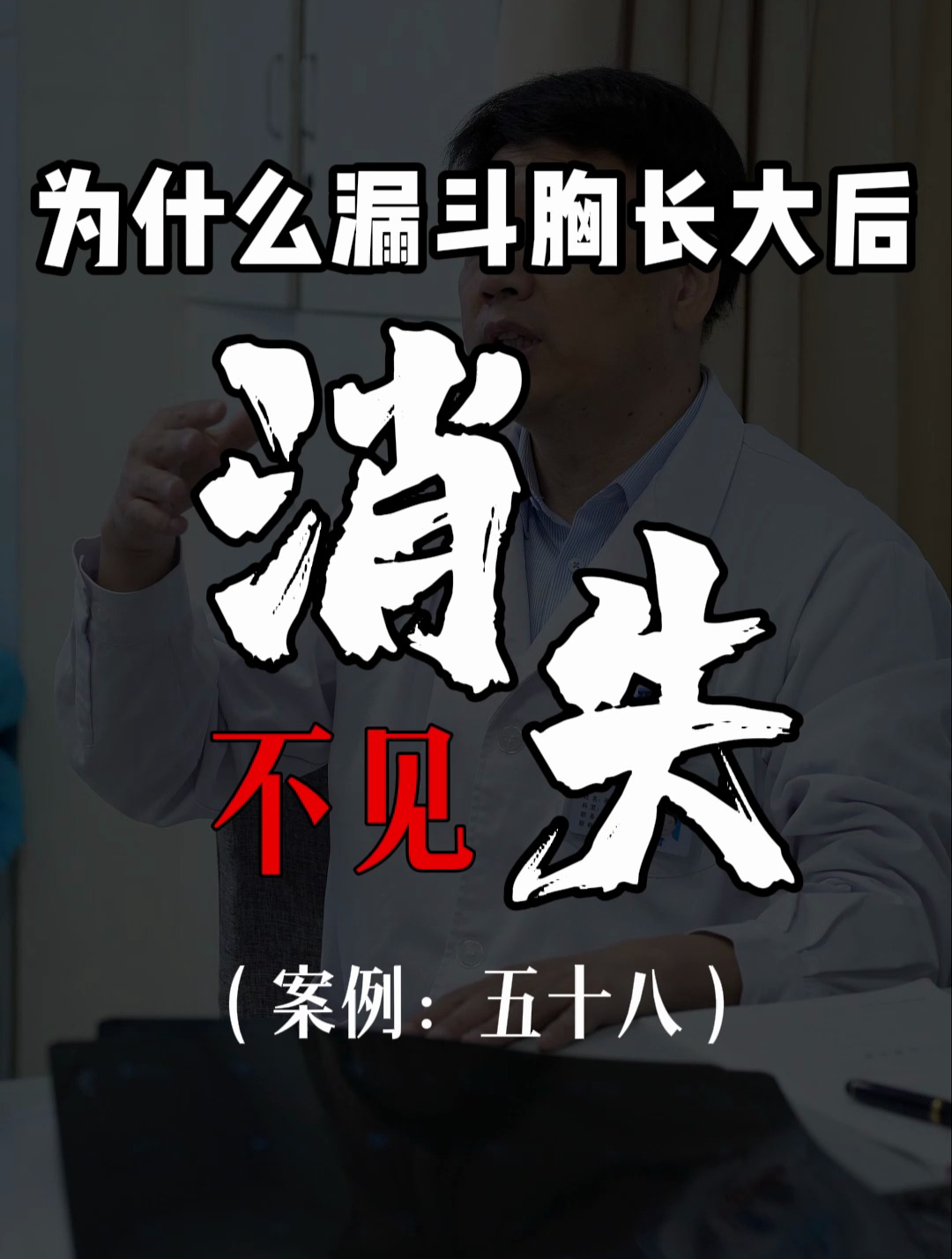 小孩发现轻微鸡胸漏斗胸不处理自己能好吗?
