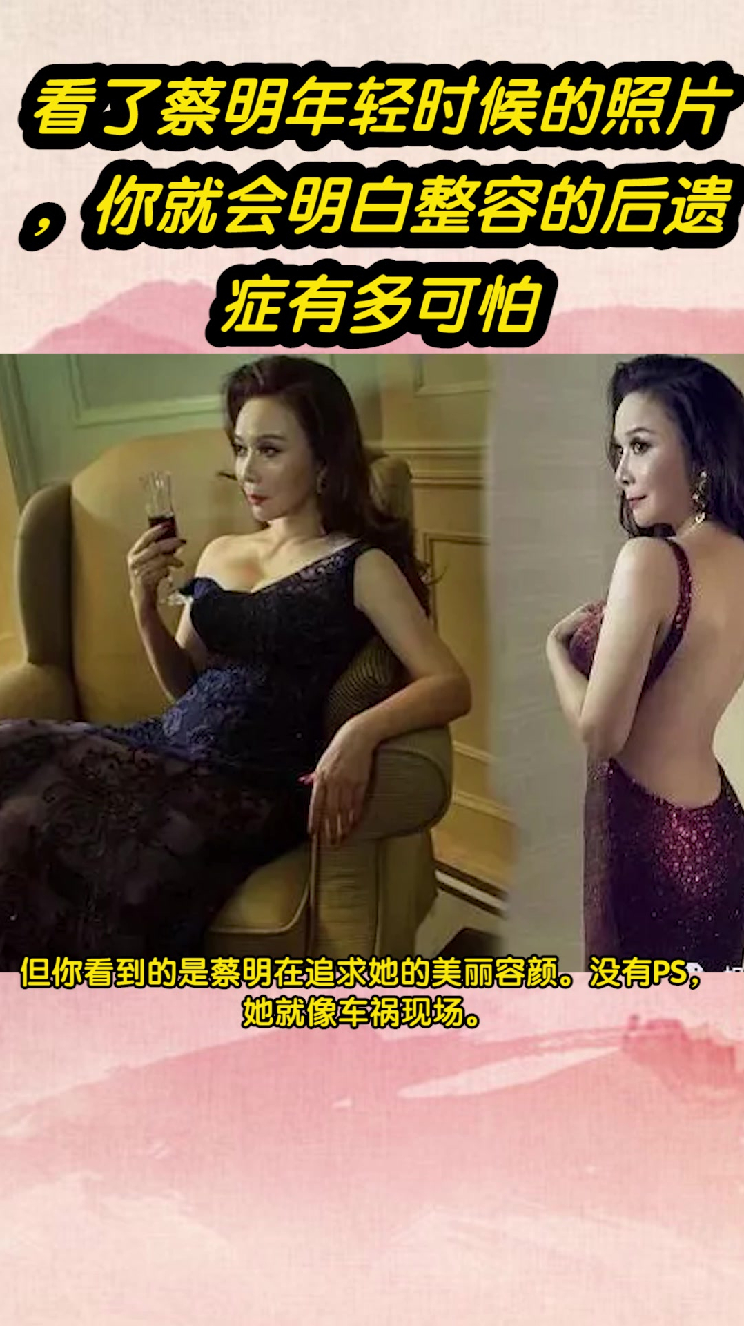 看了蔡明年轻时候的照片,你就会明白整容的后遗症有多可怕
