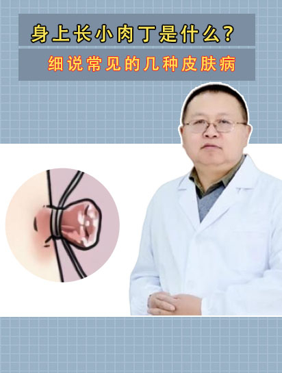 身上长小肉丁是什么?细说常见的几种皮肤病