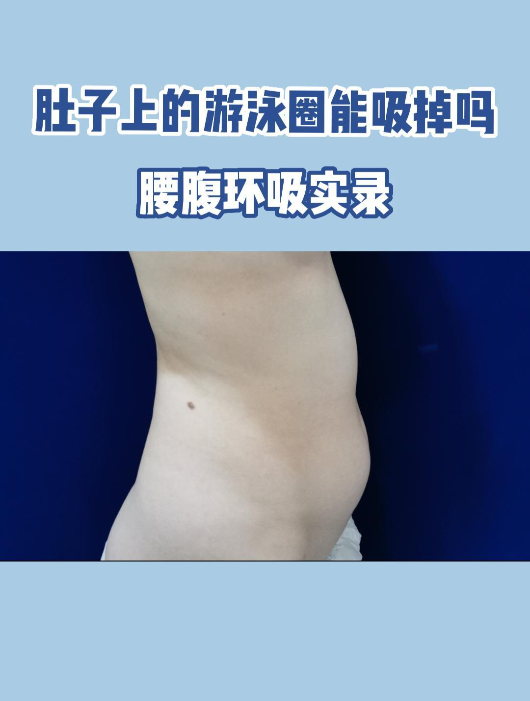 教你一招解决肚子上的游泳圈
