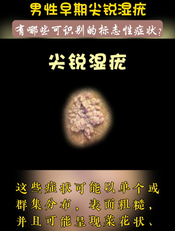 男性生殖器出现这些,可能是尖锐湿疣的早期信号!