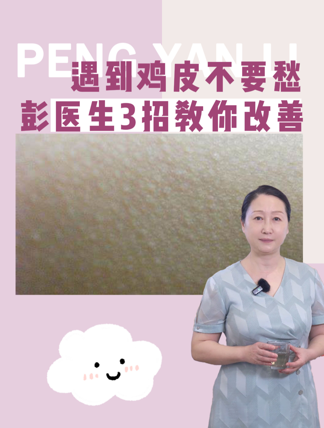 3招改善,皮肤科医生教你怎么改善鸡皮肤!